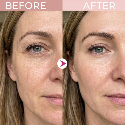 P7 Eye Renewal Crème